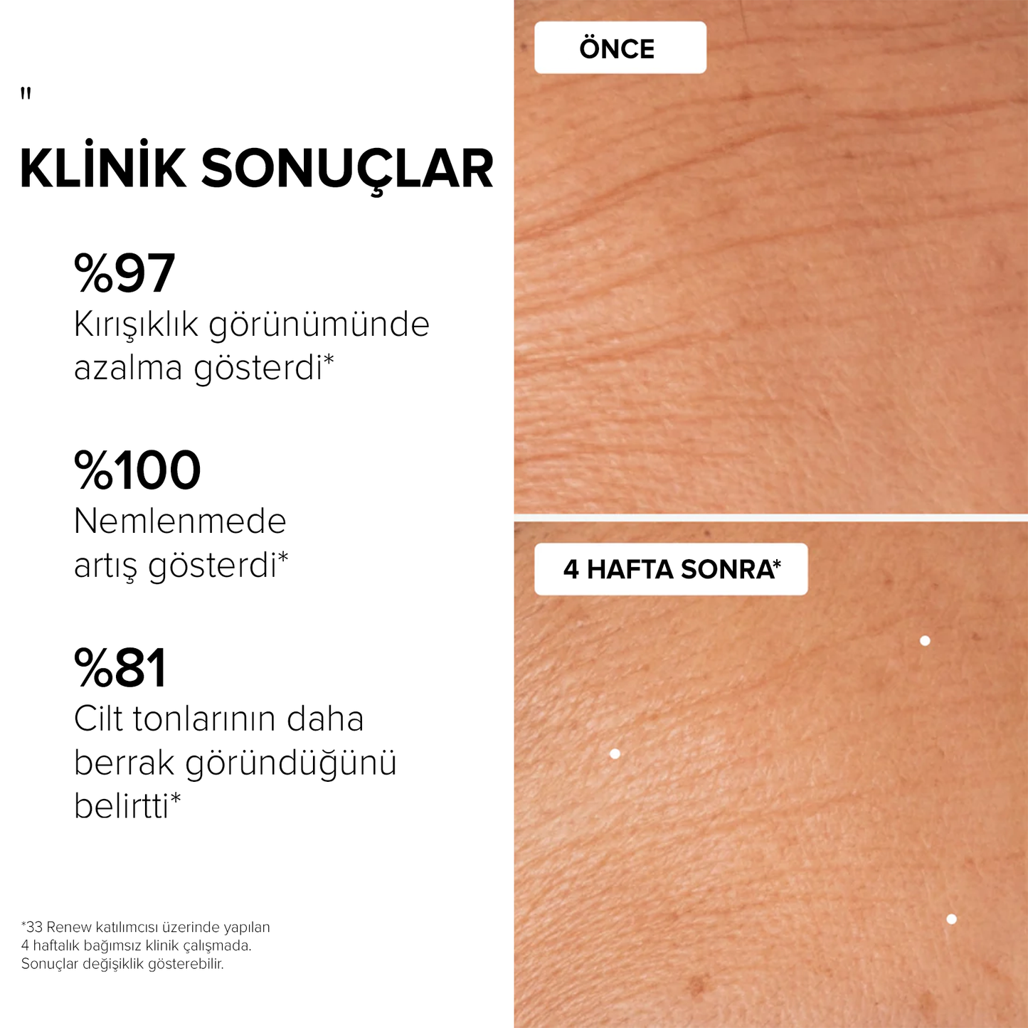Yenileyici Gece Rutini Seti - Sınırlı Üretim