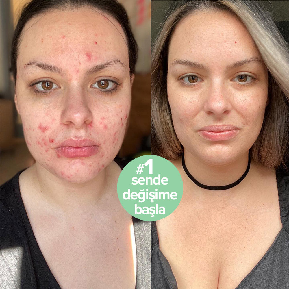 Refresh Hassas Enzim Temizleyici Yüz Jeli