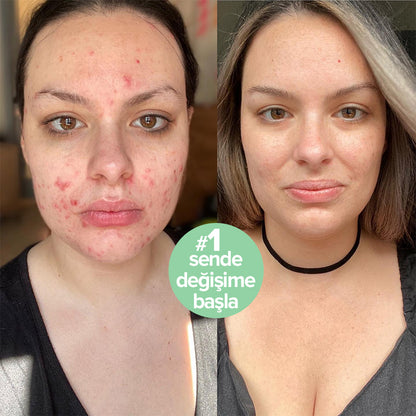 Refresh Hassas Enzim Temizleyici Yüz Jeli