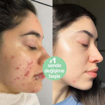 Refresh Hassas Enzim Temizleyici Yüz Jeli