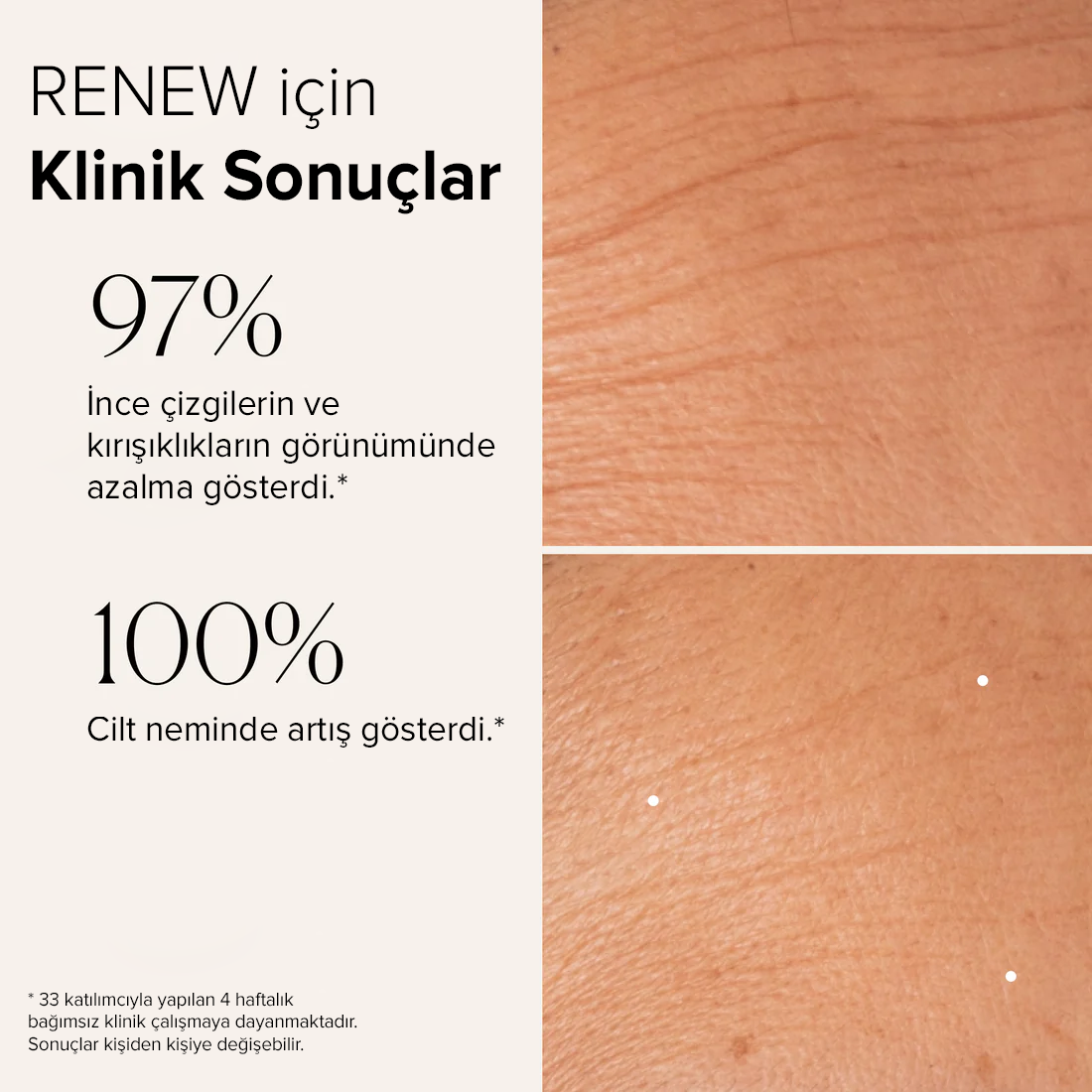 Anti-Aging İkili Renew & Prevent - En Çok Satanlar