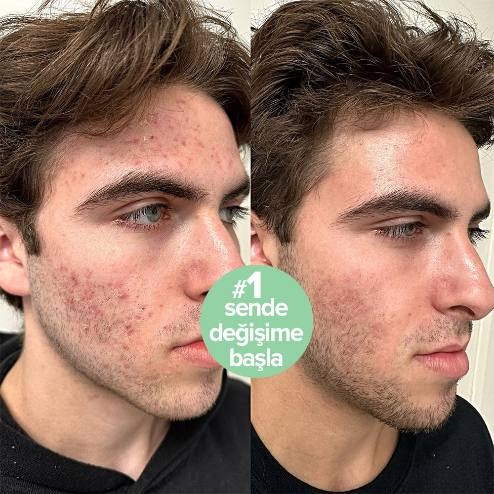 Refresh Hassas Enzim Temizleyici Yüz Jeli