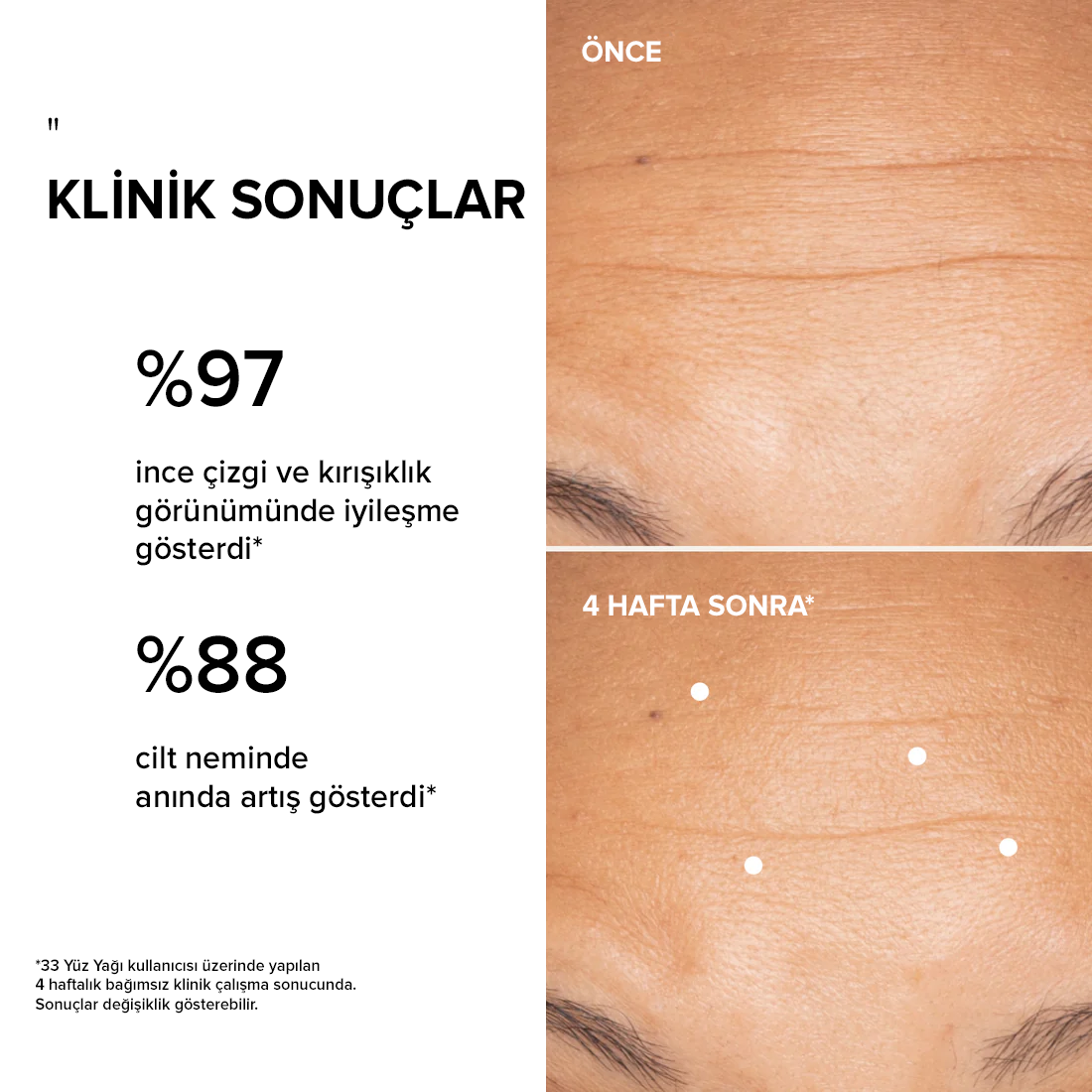 Prevent Yaşlanma Karşıtı Yüz Yağı